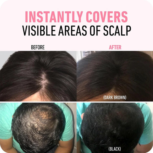 Fluffy-Hairline-Powder-Concealer-Temporary-Hair-Fibers-black-Hair-Root-Cover-Up-Gray-Coverage-Hairline-Shadow.jpg